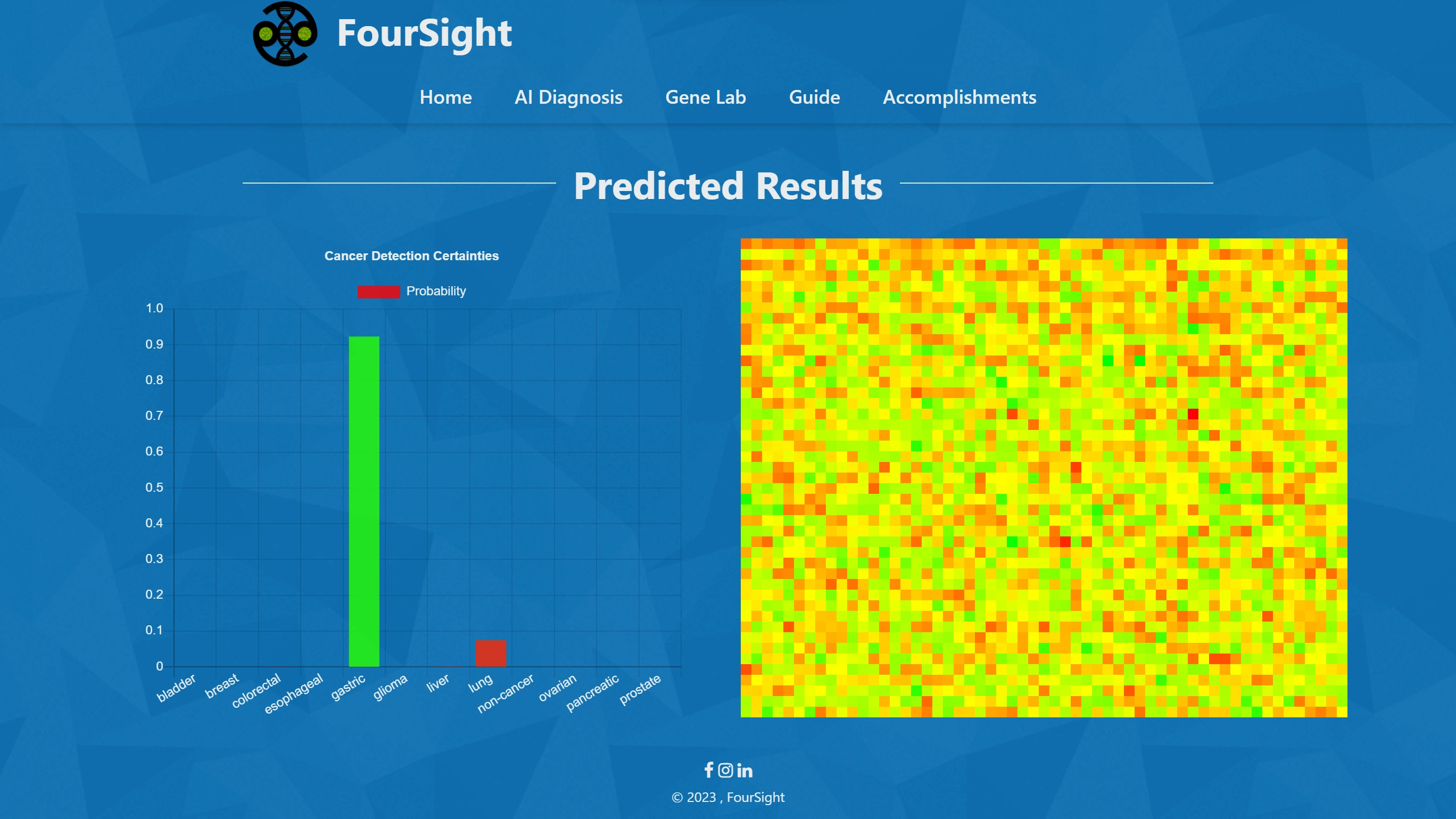 Screenshot of AI cancer detection diagnosis from Foursight website